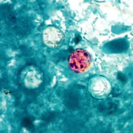 CDC, Pa. health officials tracking an intestinal parasite that causes ‘explosive’ bowel movements